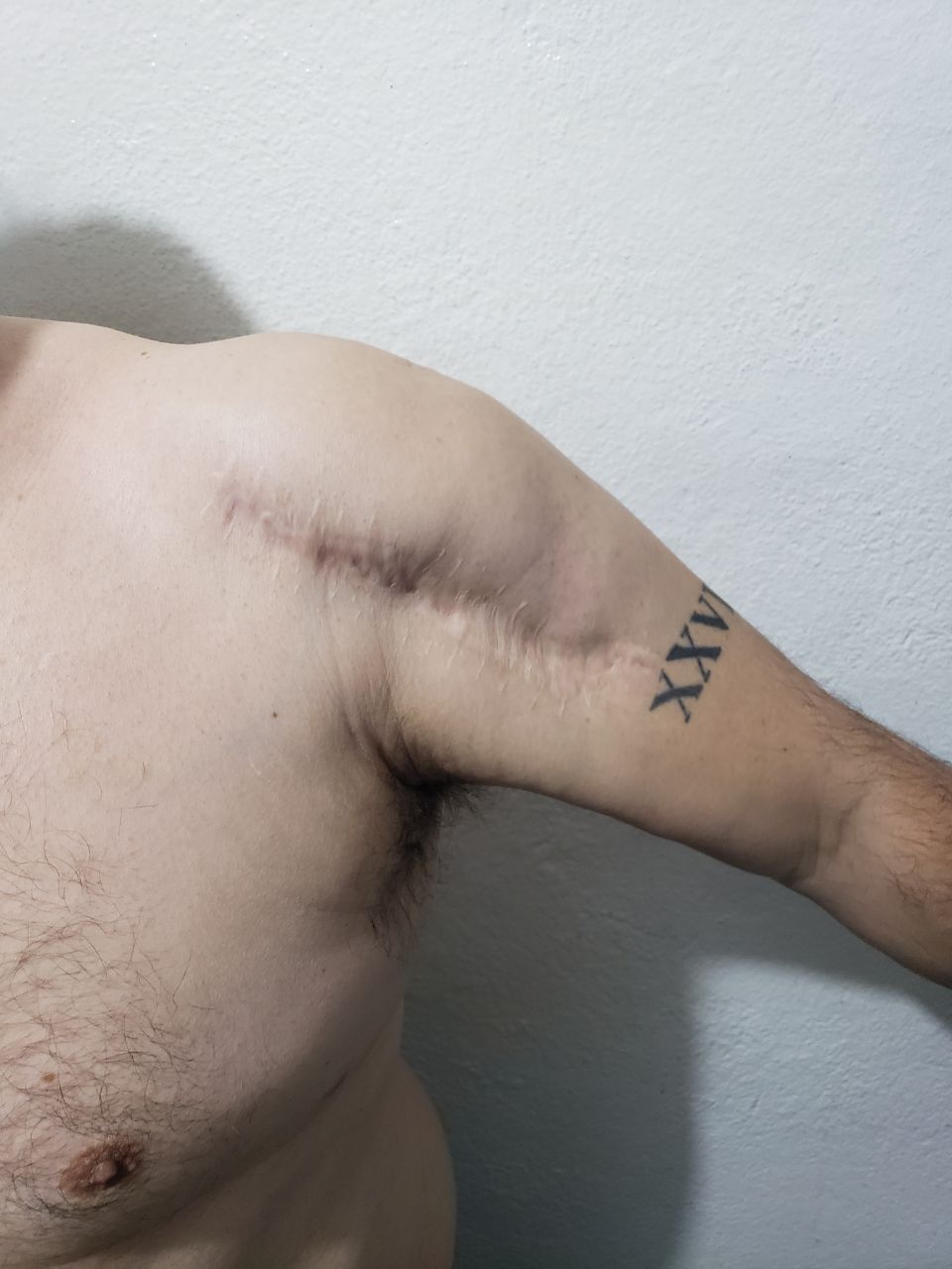 Huellas de la tortura a Juan Carlos Moreno Ochoa para que se incriminara por el homicidio de la periodista Miroslava Breach. Foto: Los Ángeles Press