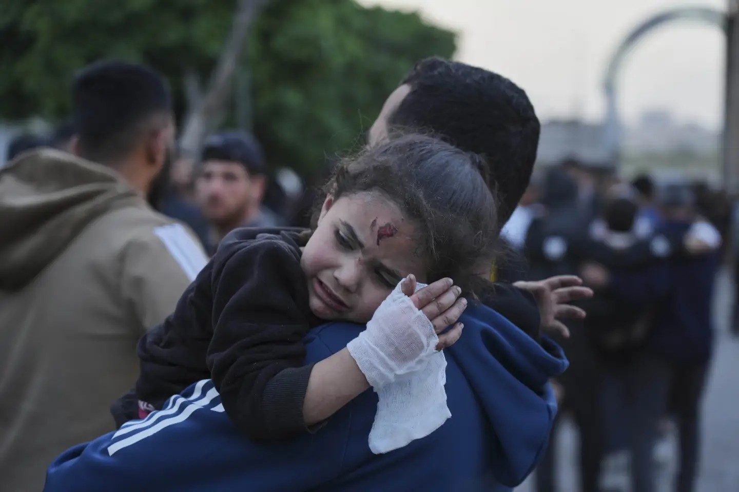 Una niña herida por el ataque aéreo israelí del 3 de abril de 2025 es llevada al hospital. Foto AP/ Jehad Alshrafi