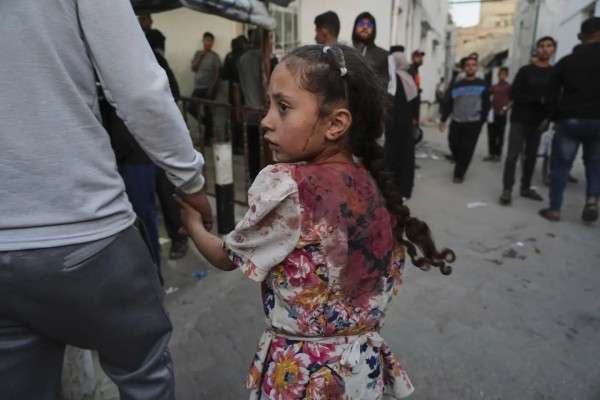 Devastador impacto en Gaza: mujeres y niños, principales víctimas
