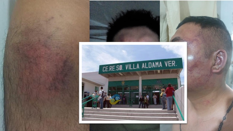 Más de 100 presos lesionados por tortura masiva en Cefereso #5