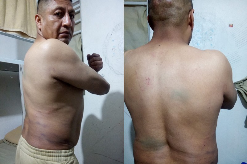 Félix Laurencio Mendoza muestra los golpes sufridos durante la tortura del 16 de agosto de 2025 a manos de custodios del Cefereso No. 5 Oriente. Félix Laurencio Mendoza muestra los golpes sufridos durante la tortura del 16 de agosto de 2025 a manos de custodios del Cefereso No. 5 Oriente.